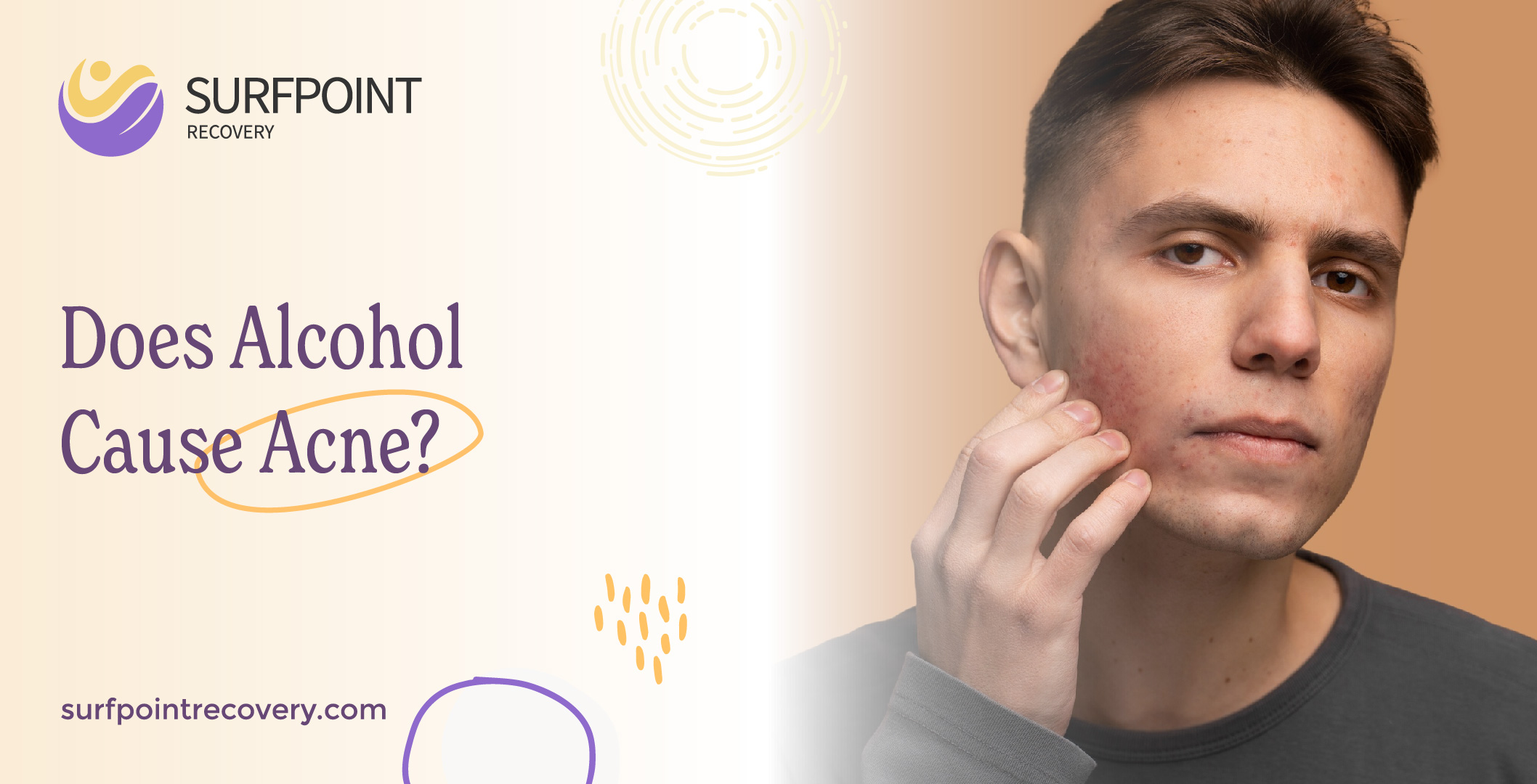 Does Alcohol Cause Acne?
